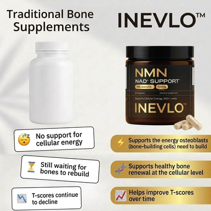 Inevlo™ NMN Bone Complex